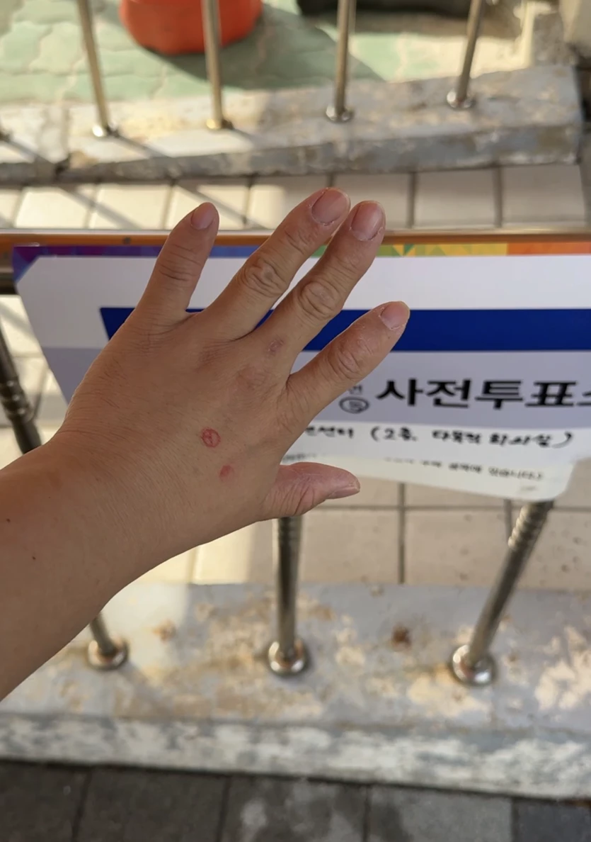 게시글 이미지