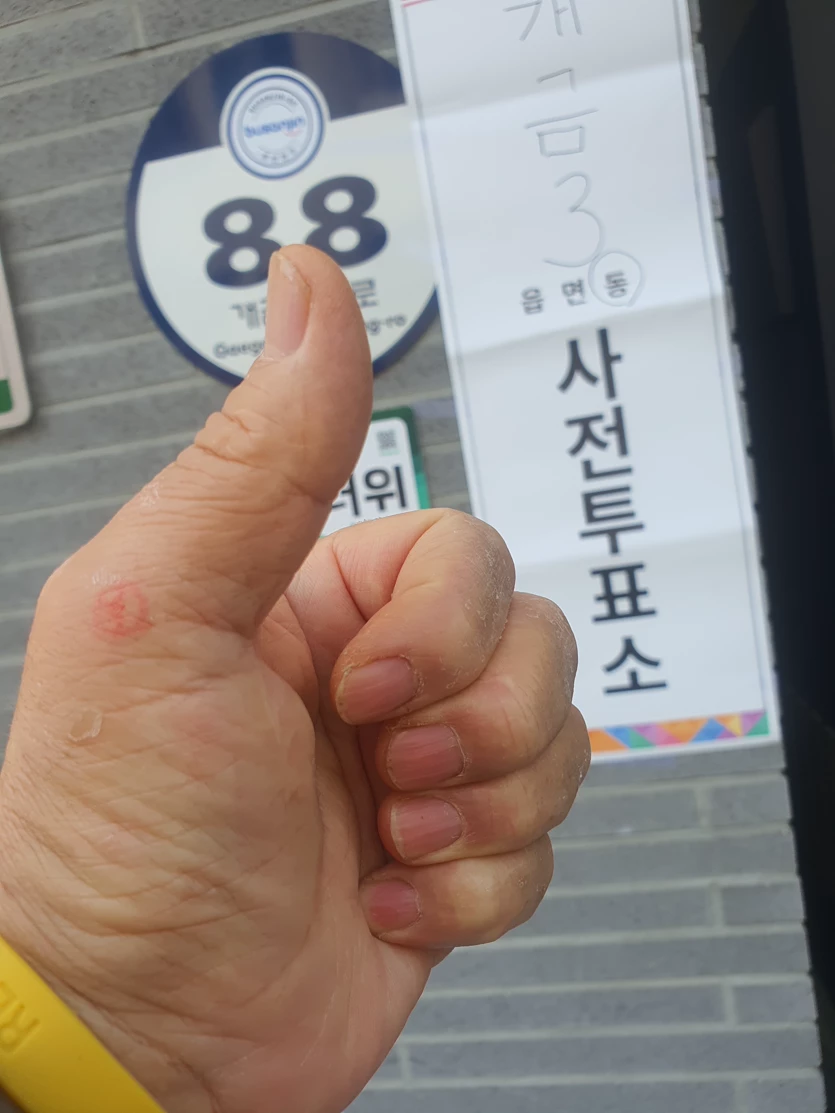 게시글 이미지