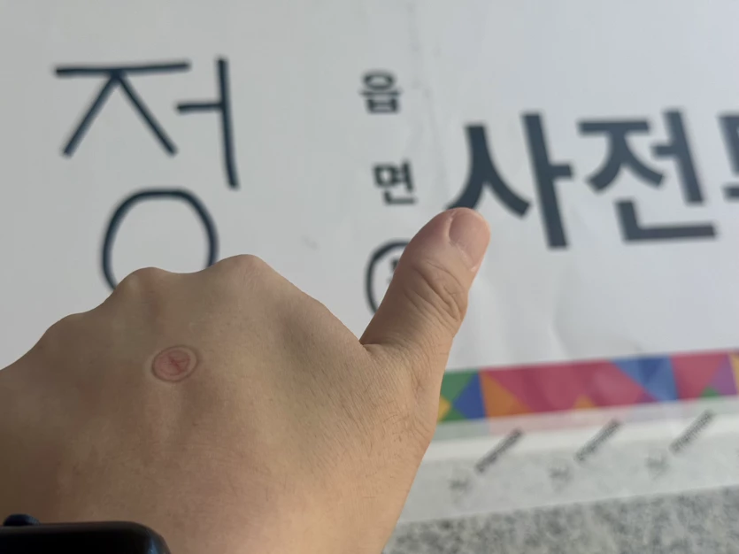게시글 이미지