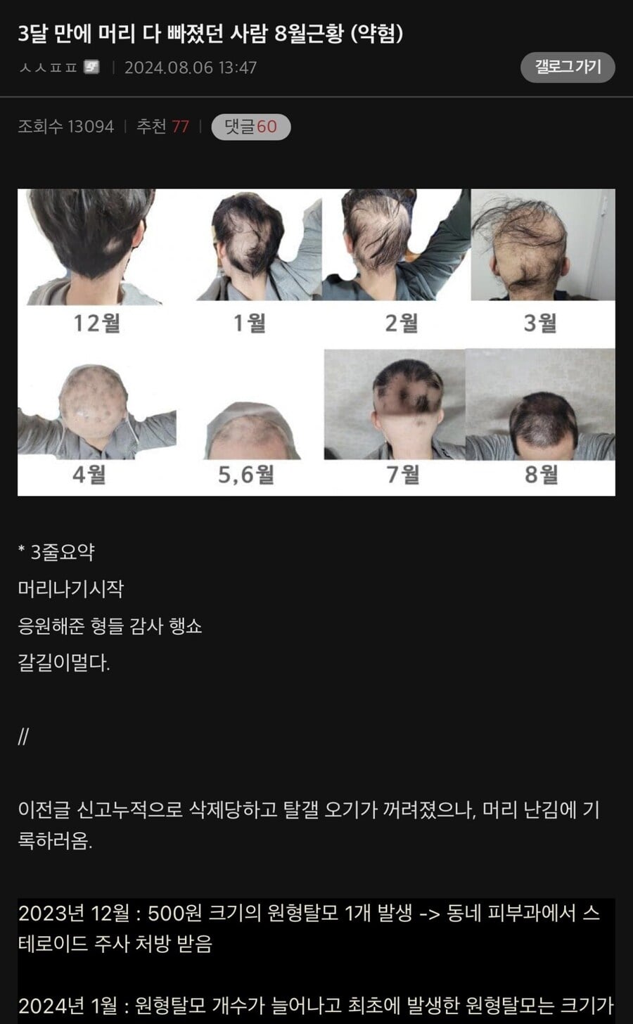 게시글 이미지