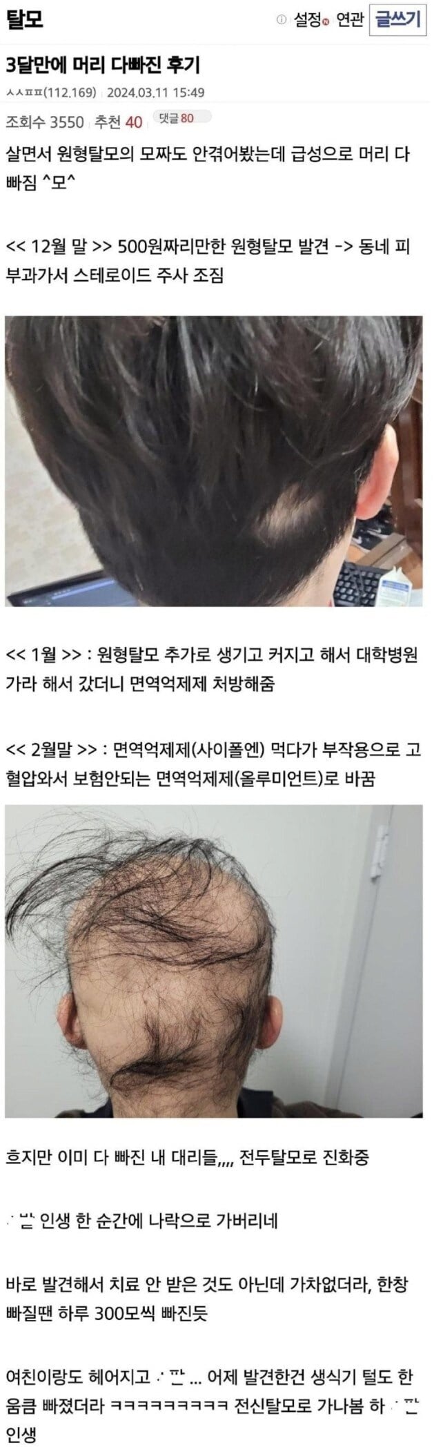 게시글 이미지