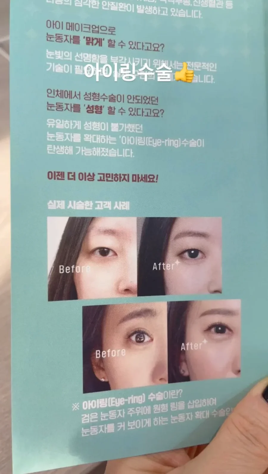 게시글 이미지