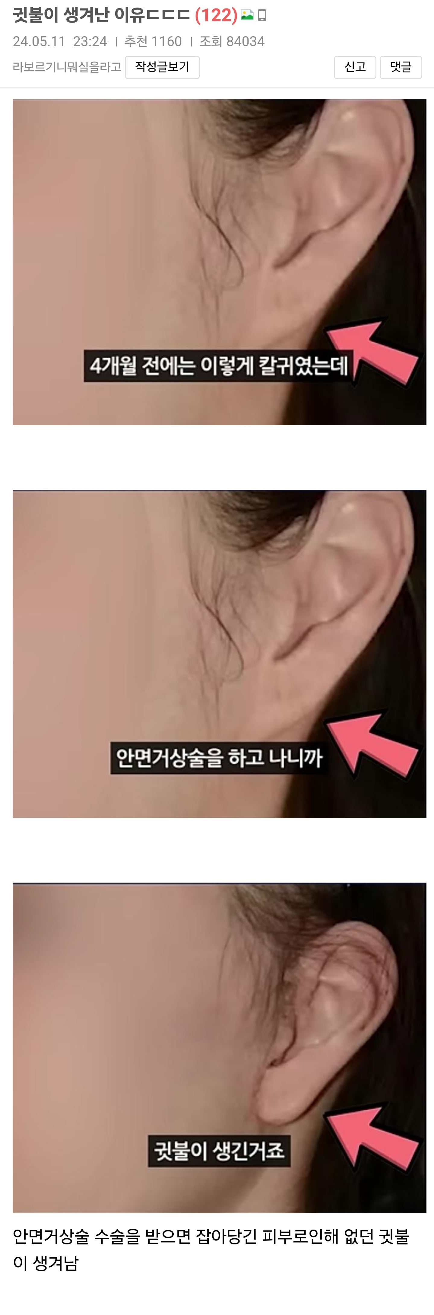 게시글 이미지
