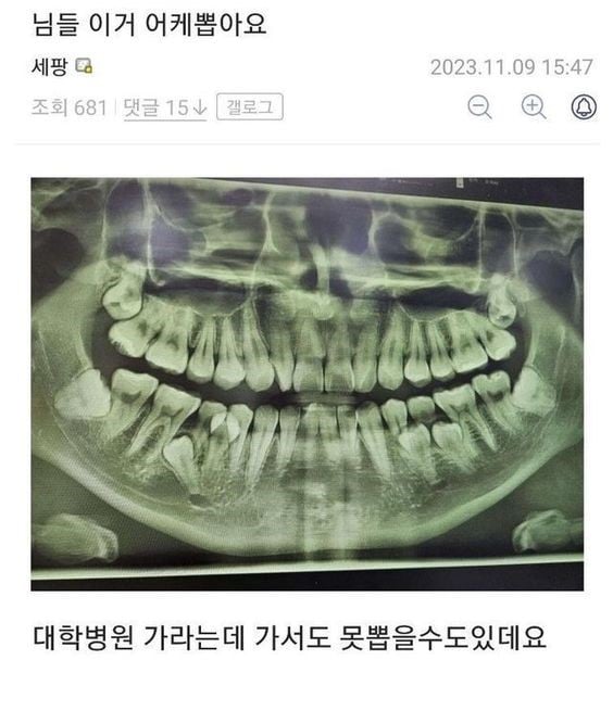 게시글 이미지