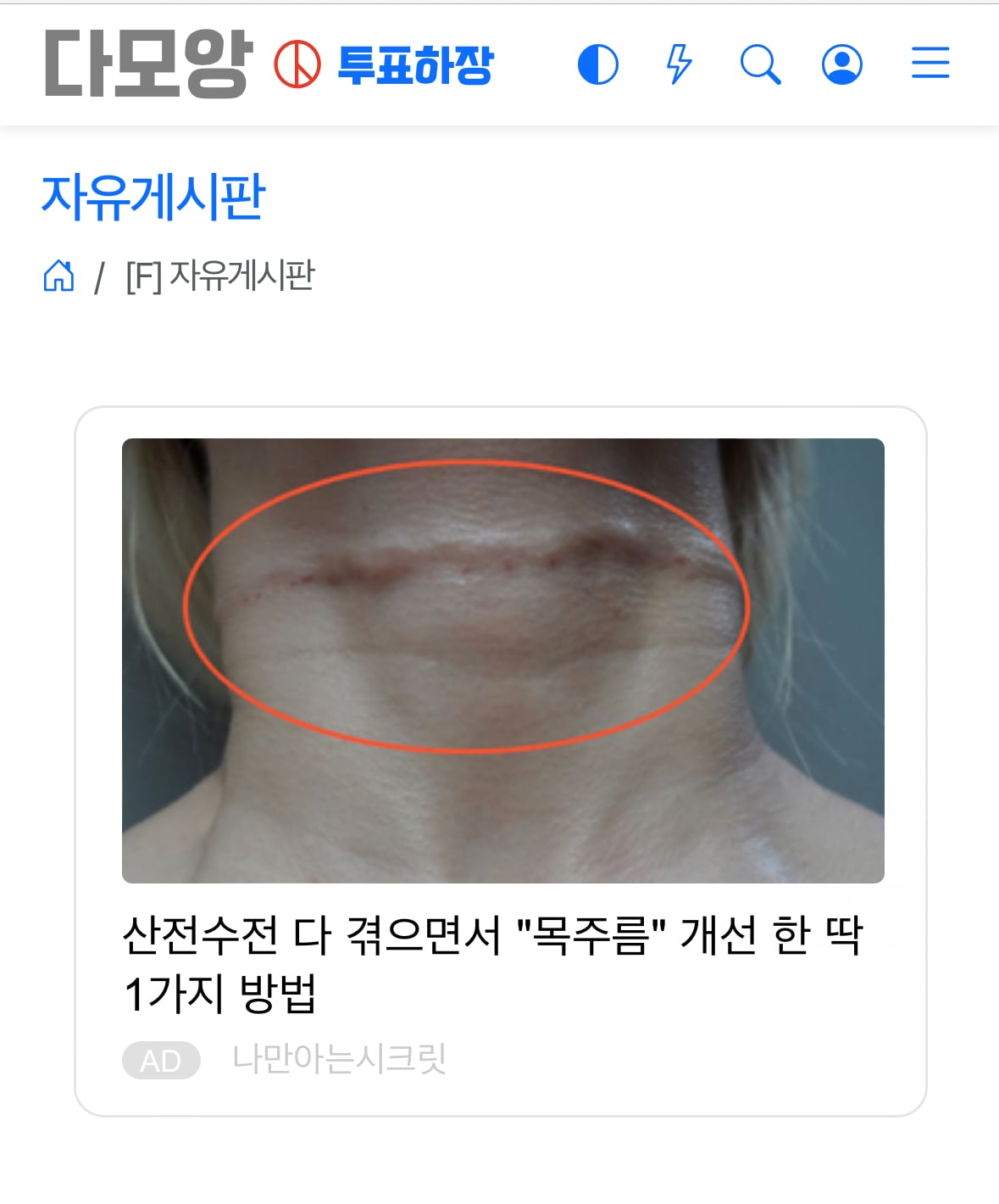 게시글 이미지