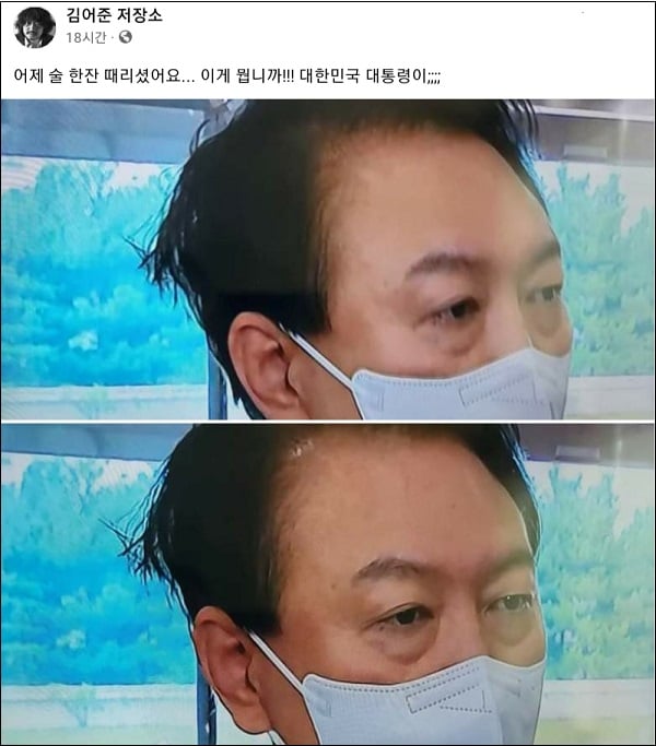 게시글 이미지