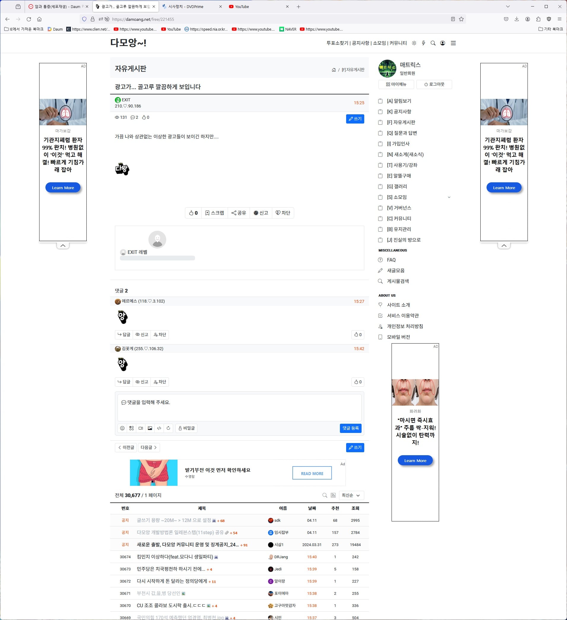 게시글 이미지