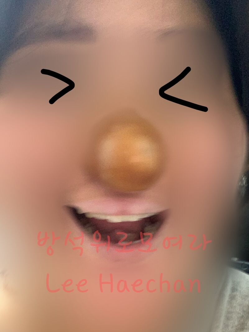 게시글 이미지