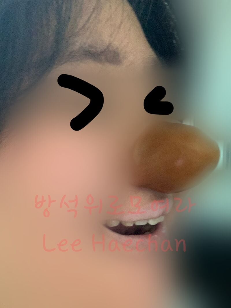 게시글 이미지