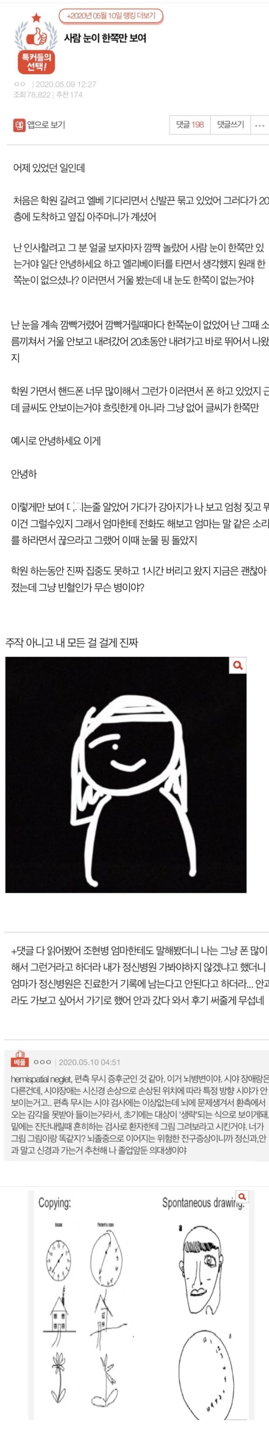 게시글 이미지