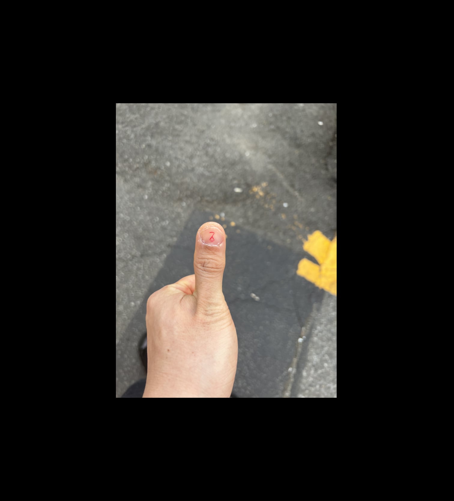 게시글 이미지