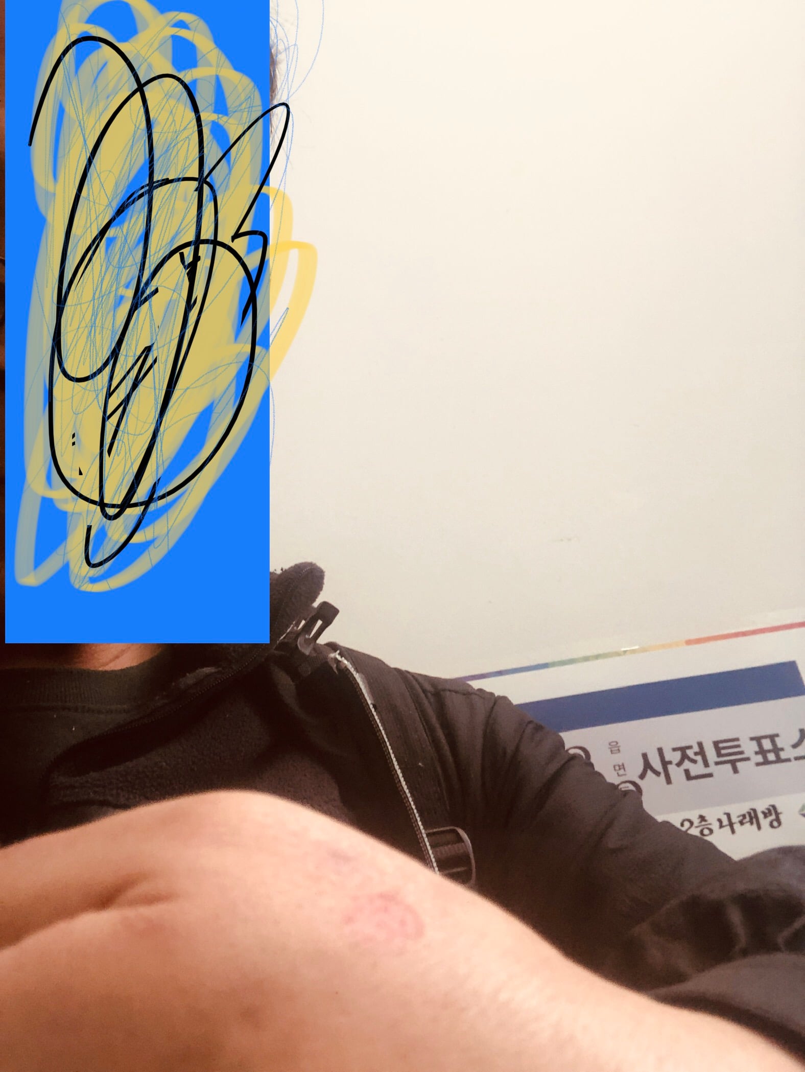 게시글 이미지