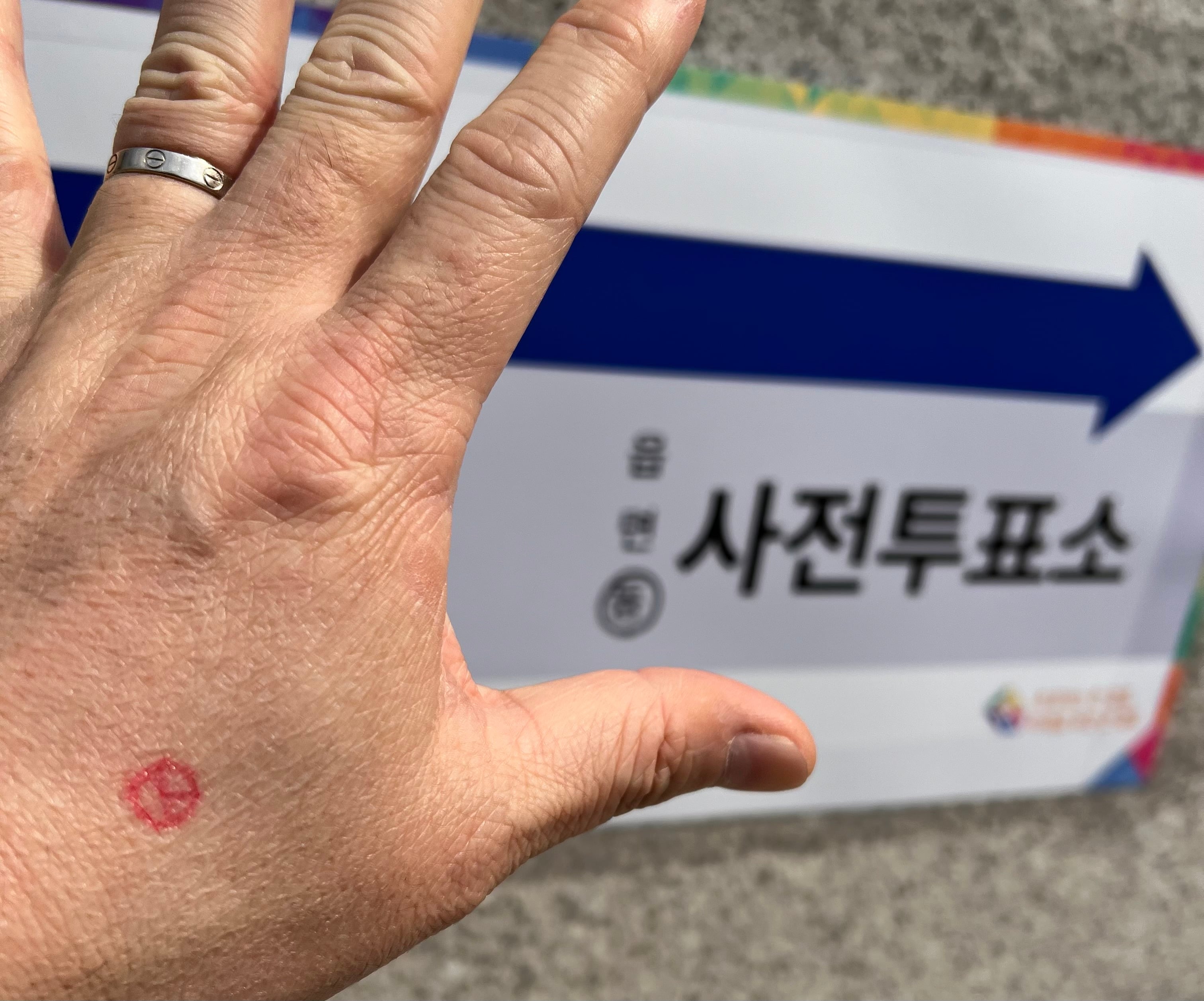 게시글 이미지
