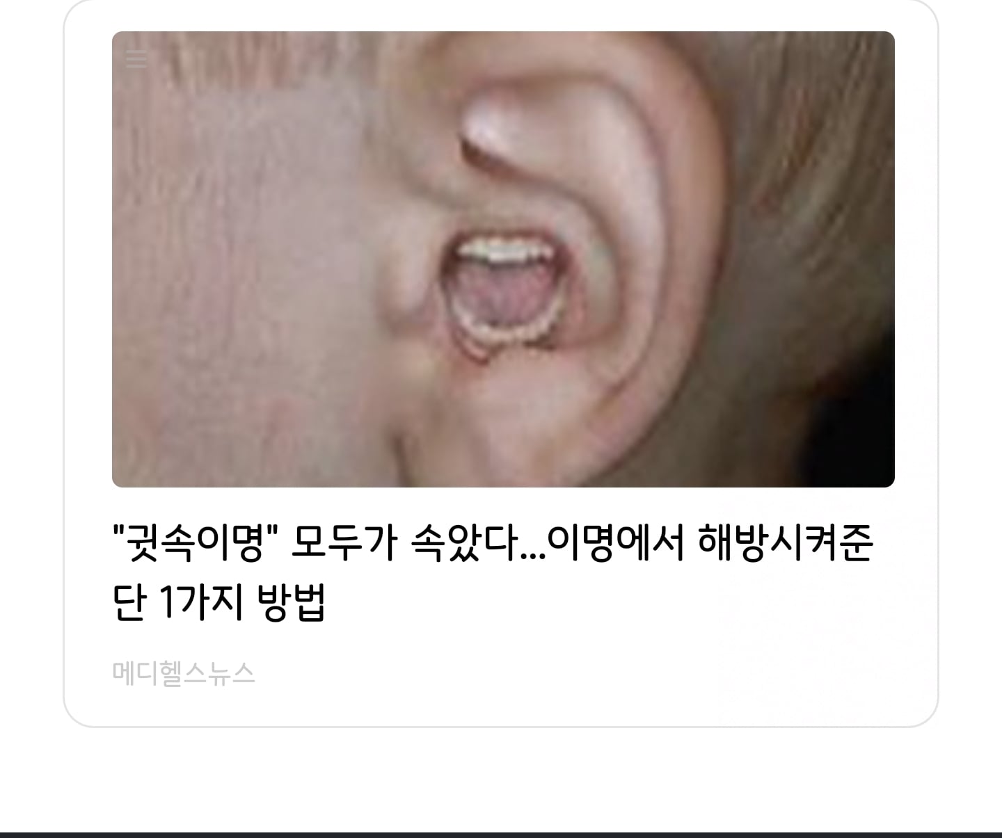 게시글 이미지