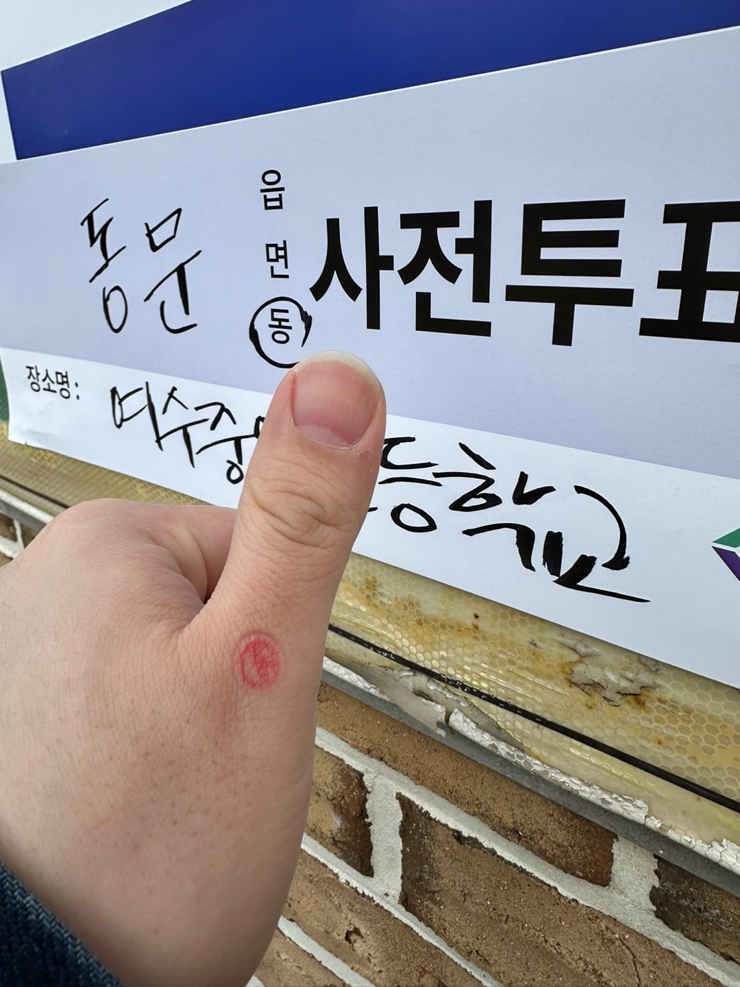 게시글 이미지