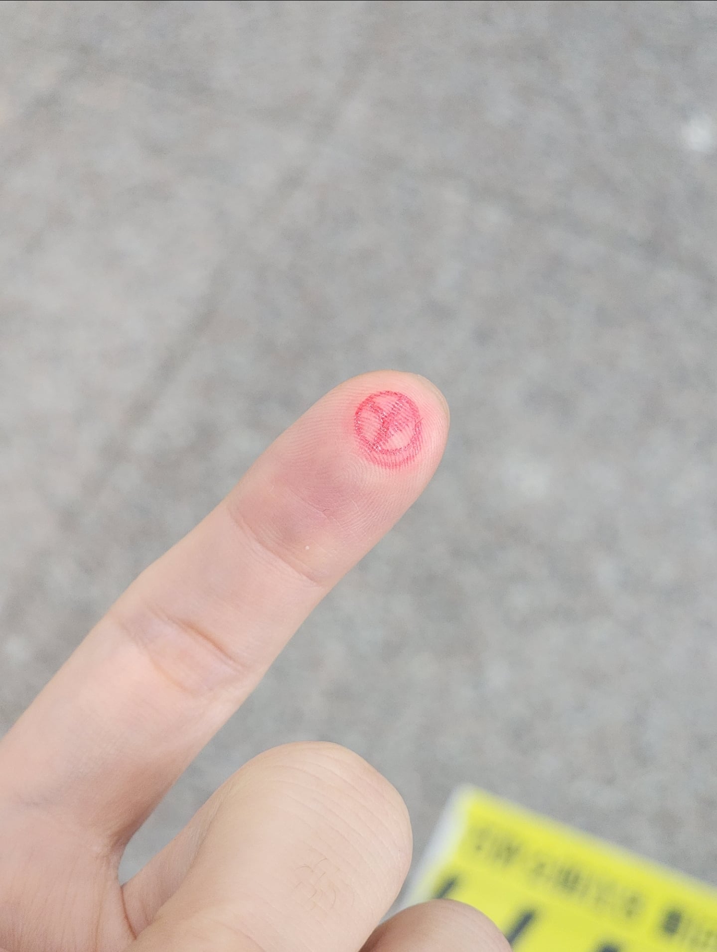 게시글 이미지