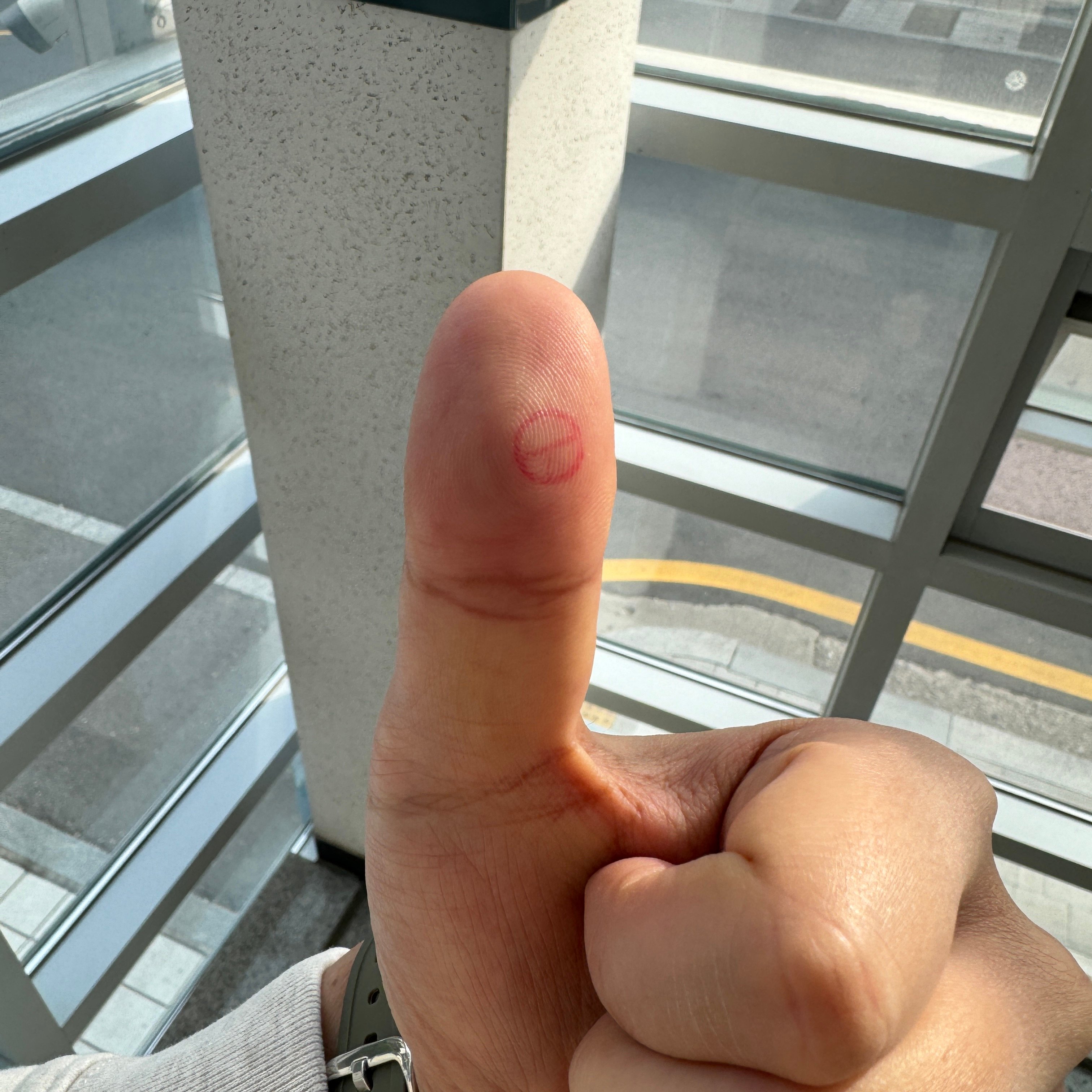 게시글 이미지