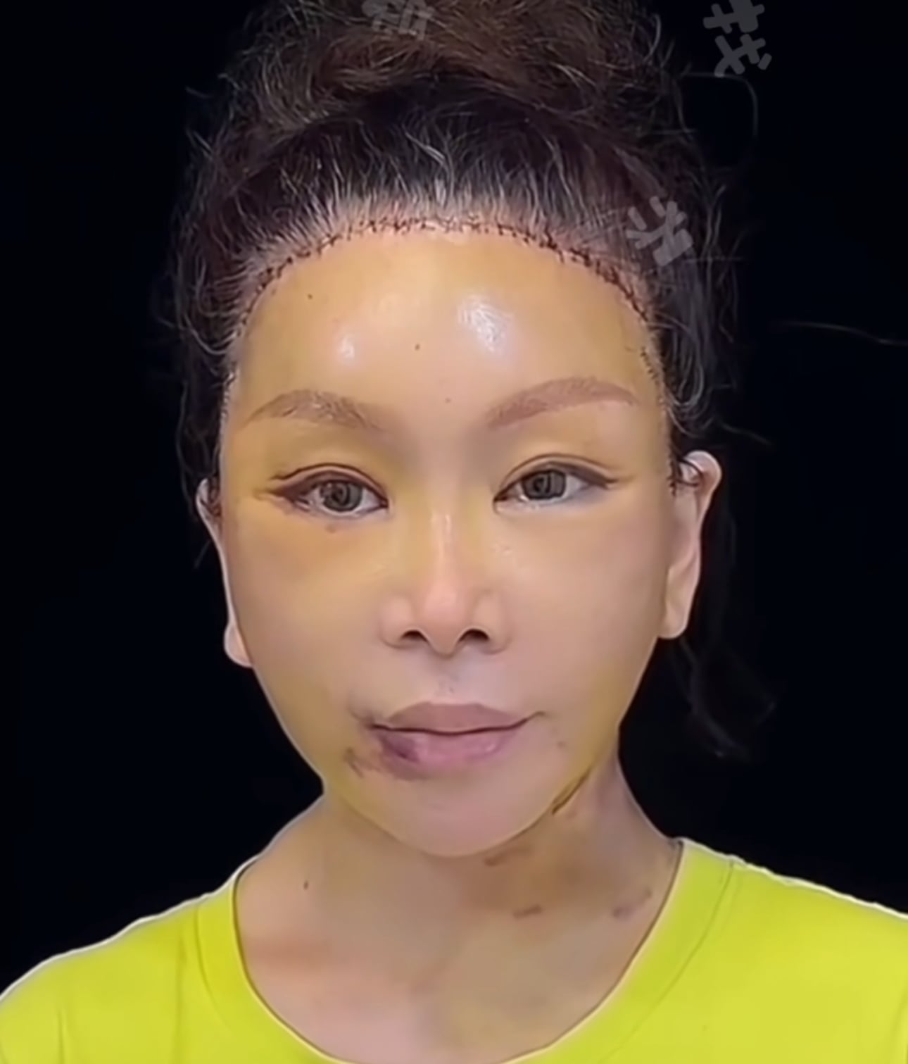 게시글 이미지
